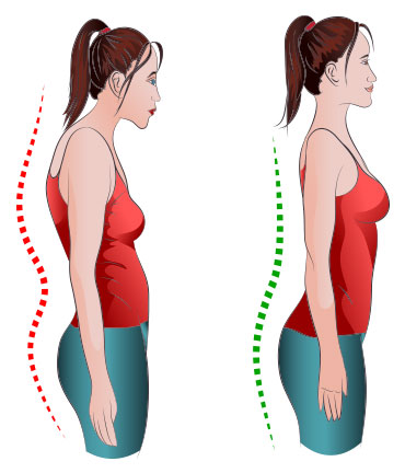 Postura adecuada vs postura incorrecta