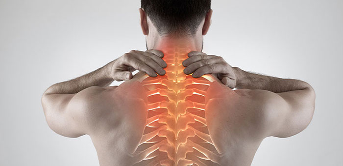 Man with upper back pain before chiropractic treatment from Goodyear chiropractor